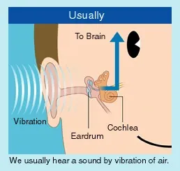 air-conduction.webp